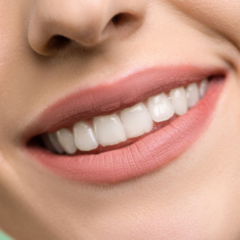 Estética